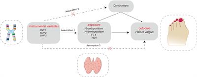 Causal relationship between thyroid dysfunction and hallux valgus: A two-sample Mendelian randomization study